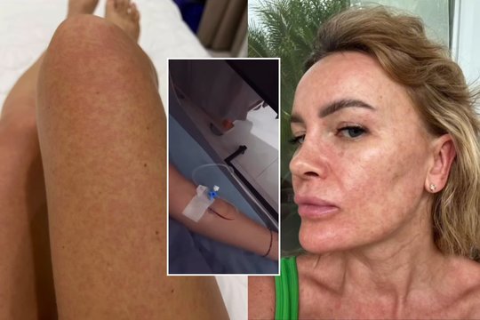 K. Meseguer parodė, kas nutiko jos kūnui Balyje: pagalbos kreipėsi į sekėjus