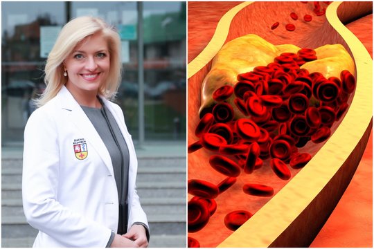 Už MTL cholesterolį 6 kartus „piktesnis“ kraujo rodiklis: kardiologė prašo – išsitirkite bent kartą gyvenime