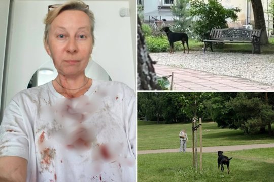 Po dobermano išpuolio prieš pudelį Vilniuje – naujos detalės ir policijos reakcija