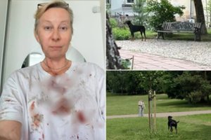 Po dobermano išpuolio prieš pudelį Vilniuje – naujos detalės ir policijos reakcija