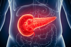 Sukūrė neįprastą testą: parodo, ar žmogus neserga mirtingiausia vėžio forma
