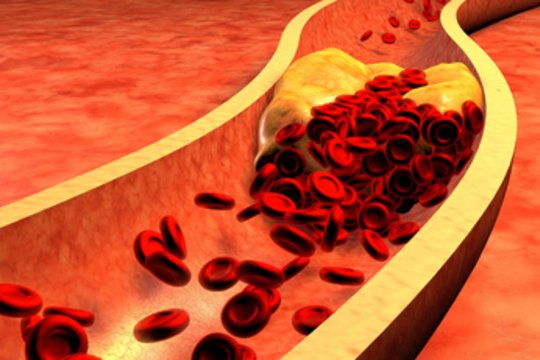 Dietologė šį vaisių valgo kasdien – didžiausias cholesterolio priešas