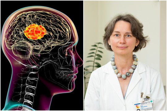 Smegenų vėžys: profesorė išvardijo, kokie požymiai išduoda galvos auglį