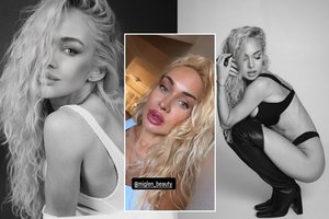 Oksana Pikul ryžosi išvaizdos pokyčiams: parodė, kaip atrodo po procedūros