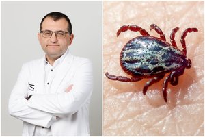 Įsisiurbė erkė? V. Kasiulevičius paaiškino, kokie simptomai pavojingiausi