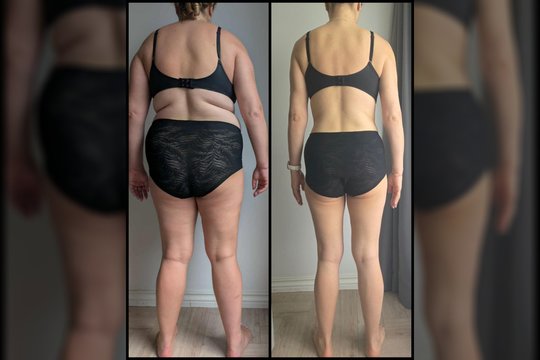 30 kilogramų numetusi vilnietė tapo visiškai kitu žmogumi: pasakė, ką pradėjo valgyti kitaip