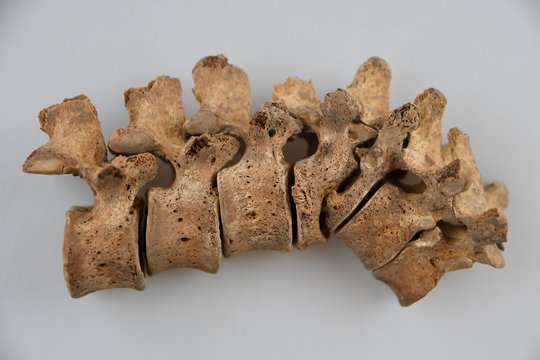 Įgyvendintas reikšmingas bioarcheologinis tyrimas: atkūrė senovės vilniečių gyvenimo istorijas