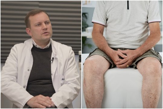 Gydytojas atskleidė, dėl kokio įpročio kinai prostatos vėžiu serga 10 kartų rečiau nei lietuviai