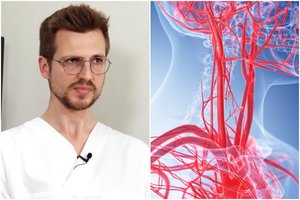 Kardiologas kreipėsi į visus, kam virš 40 metų: insulto riziką galima įvertinti per 20 minučių