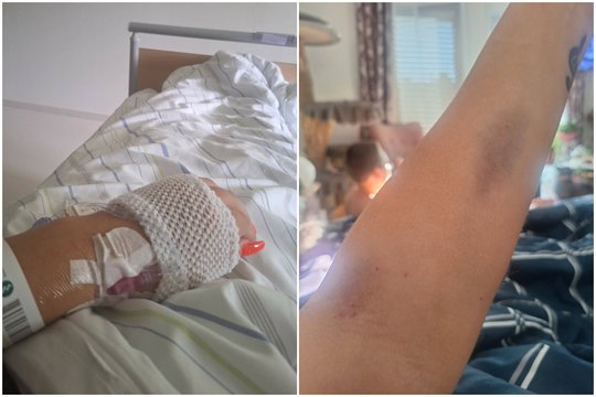 Išgirtą lieknėjimo vaistą išbandžiusi klaipėdietė atsidūrė ligoninėje: „Buvau įsitikinusi, kad mirštu“