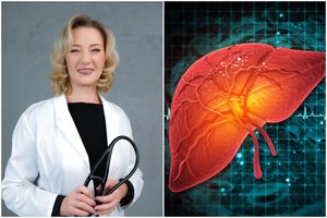 Gydytoja E. Gavelienė įvardijo 5 svarbiausius įpročius, nuo kurių priklauso kepenų sveikata