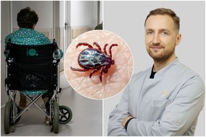 Sparčiai plinta erkinis encefalitas: gydytojas paaiškino, kodėl delsti pavojinga