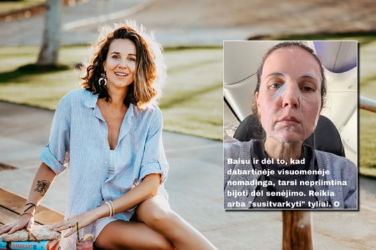 Vaiva Rykštaitė išgyvena pokyčius: „Man sunku tai priimti“