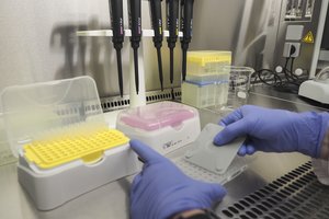 Valstybė kompensuos genetinį tyrimą pažengusiu kiaušidžių vėžiu sergančioms pacientėms