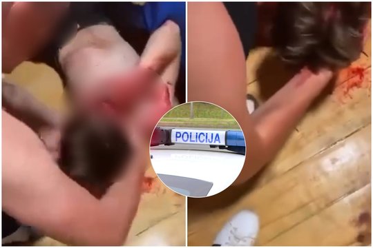 Po žiauraus jaunuolio sumušimo Druskininkuose – prokuratūros žinia: atsirado įtariamasis
