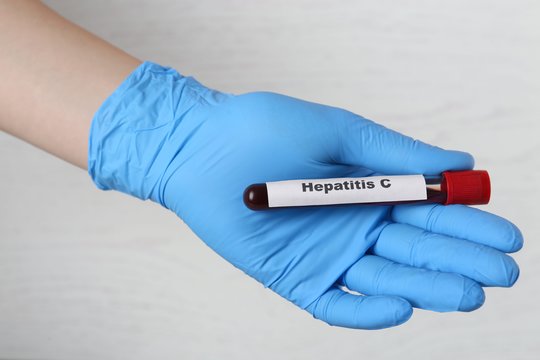 Virusinis hepatitas: ankstyva diagnostika gali išgelbėti gyvybę