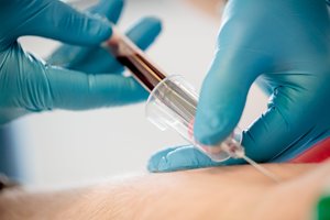 Paveldėtas pavojus: kaip genetiniai kraujo tyrimai gali padėti nustatyti ankstyvą vėžio diagnozę?