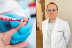 Širdies smūgio ir insulto pranašas: šio kraujo rodiklio nepakeis nei dieta, nei sportas