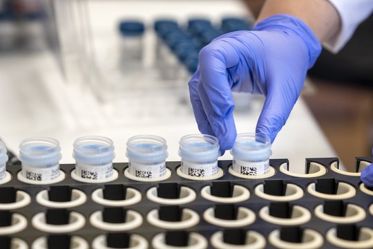 Ne visi ŽPV tipai vienodi: genotipavimas atskleidžia skirtingą gimdos kaklelio vėžio riziką