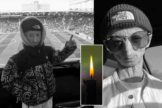 Mirė 28-erių interneto žvaigždė: su itin reta liga gyvenęs vaikinas pranoko gydytojų prognozes