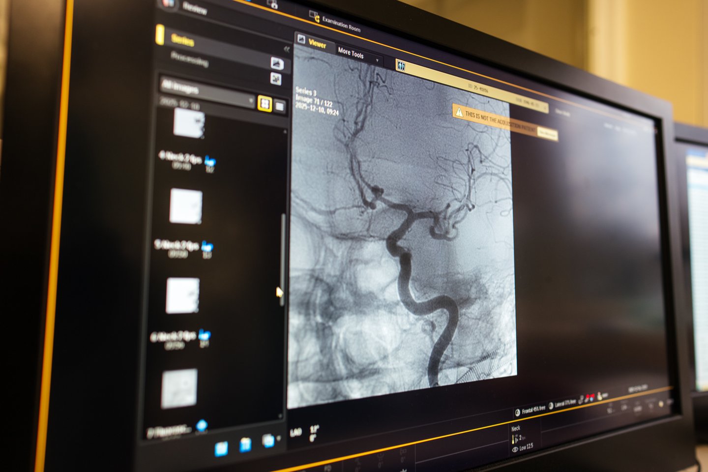 Radiologinis tyrimas<br>Pranešimo spaudai nuotr.