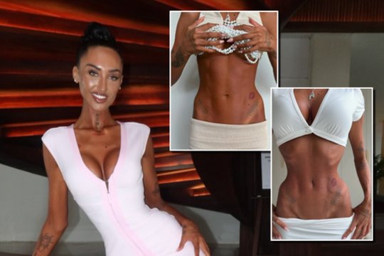 21-erių influencerės pokytis pribloškė: po „Barbės liemens“ operacijos internautai neslepia nerimo