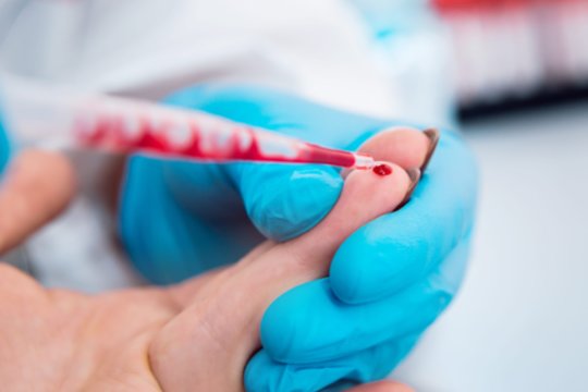 Dalies ligų simptomus lengva pražiūrėti: kokius profilaktinius tyrimus verta atlikti pagal amžių?