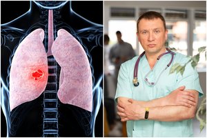 Onkologas išvardijo klastingo vėžio požymius: šie ženklai negali praslysti pro akis