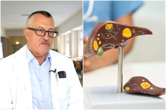 Profesorius įspėjo dėl kepenų ligos: griebia ir jauną, ir senjorą