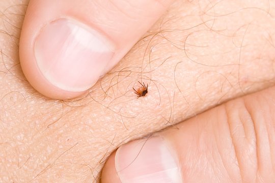 Perspėja: ekstremalūs orai augina naują infekcijų bangą ir grasina nuginkluoti šiuolaikinę mediciną