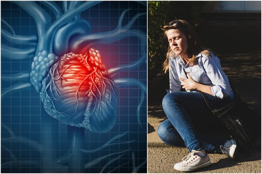 Ar magnetinės audros iš tiesų gali sukelti infarktą? Gydytoja pateikė atsakymą