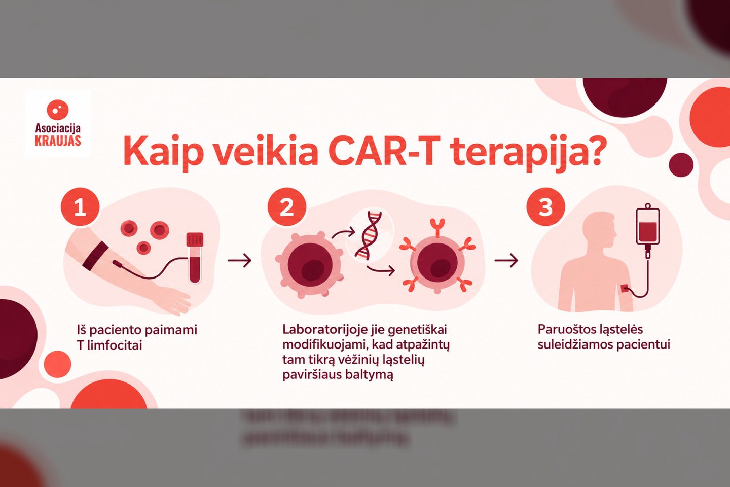 Limfomos gydymas<br>Pranešimo spaudai infografikas