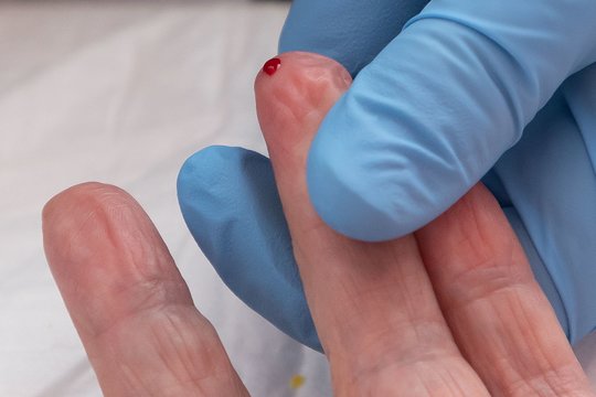 Hemofilija gali likti nepastebėta metų metus: profesionalus sportininkas diagnozę išgirdo tik suaugęs