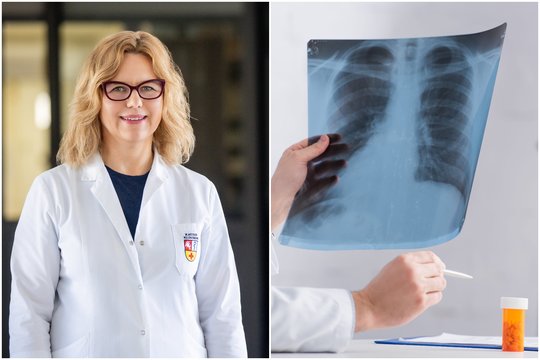 Ypač pavojinga plaučių liga: gydytojai įspėja – pirmą signalą lengva pražiopsoti