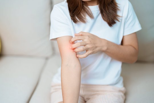 Vos atvėso orai – oda pradėjo niežėti: tai paprastas sausumas ar jau dermatitas?