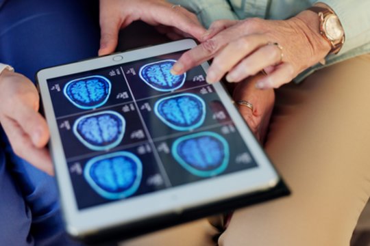 Medicinos proveržis: keičiasi požiūris į Alzheimerio ligą