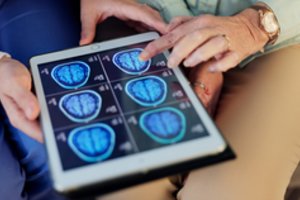 Medicinos proveržis: keičiasi požiūris į Alzheimerio ligą