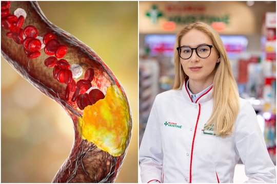 Padidėjęs cholesterolis gali nesukelti jokių simptomų: kam vertėtų pasitikrinti?