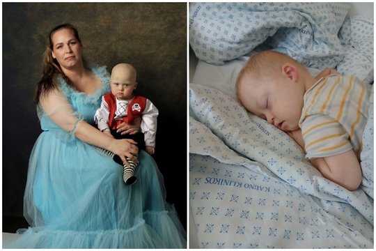 Dėl dvejų metų Marko kovojanti mama išgirdo sunkius gydytojų žodžius: jos sūnus miršta