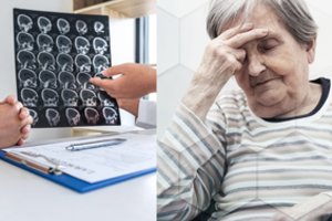 Organizmas apie insultą gali įspėti prieš mėnesį – štai į ką reikėtų atkreipti dėmesį