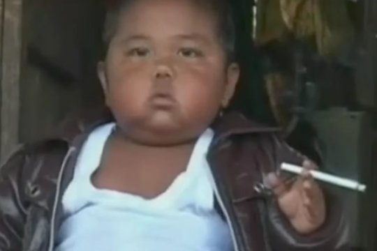 Sunku patikėti: du pakelius cigarečių per dieną surūkydavęs dvimetis indonezietis išaugo tikru gražuoliu