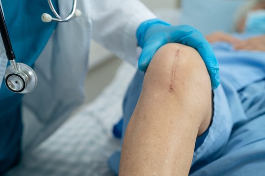 Naujas sąnarys daugeliui metų: kaip ilgai tarnauja endoprotezai?