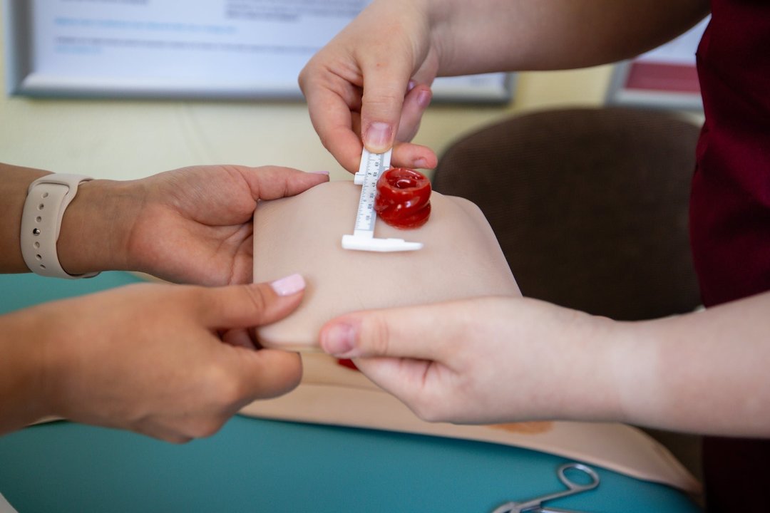 Kaunietė Aistė dėl vėžio negalėjo normaliai valgyti: gyvybę išgelbėti padėjo stoma