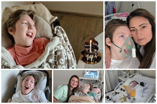 Trynukų laukusios Alinos išbandymai: išgyvenusiai dukrai jau 16-ka, bet mama jai – ir akys, ir rankos