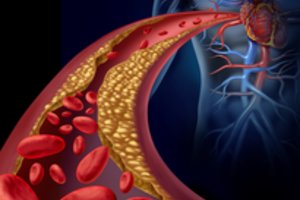 Cholesterolio kontrolei – naujas požiūris: kodėl vis daugiau dėmesio skiriama augalų steroliams?