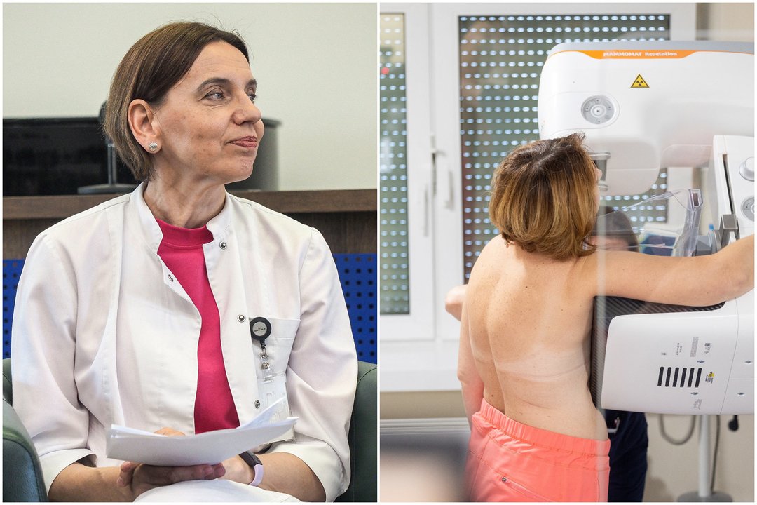 Kovoje su krūties vėžiu – svarbus lūžis: medikai kreipėsi į 45–74 metų moteris