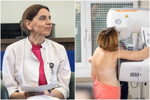 Kovoje su krūties vėžiu – svarbus lūžis: medikai kreipėsi į 45–74 metų moteris