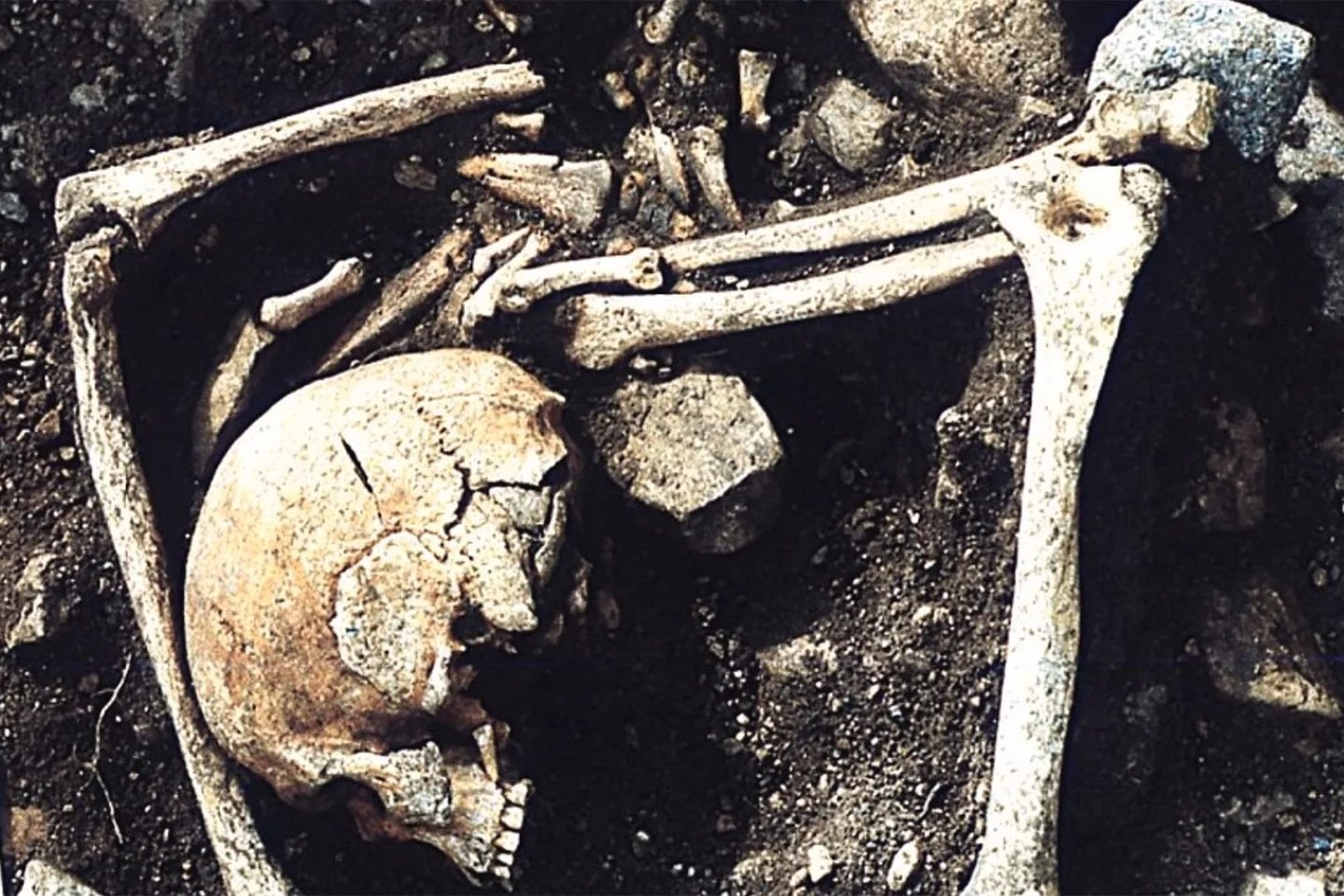 Archeologai ištyrė Latvijoje rastą šešių žmonių kapavietę, kurioje palaidoti asmenys galėjo būti nužudyti per vikingų antpuolį prieš 1200 metų. Čia matomi vieno asmens palaikai, kurio rankos buvo šiek tiek sulenktos ir sudėtos virš galvos.
