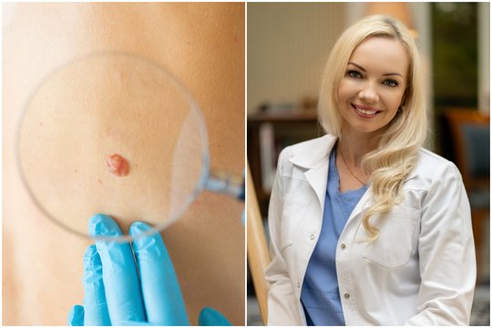 Vėžiui pastebėti – „bjauriojo ančiuko“ taisyklė: gydytoja prašo ją įsidėmėti