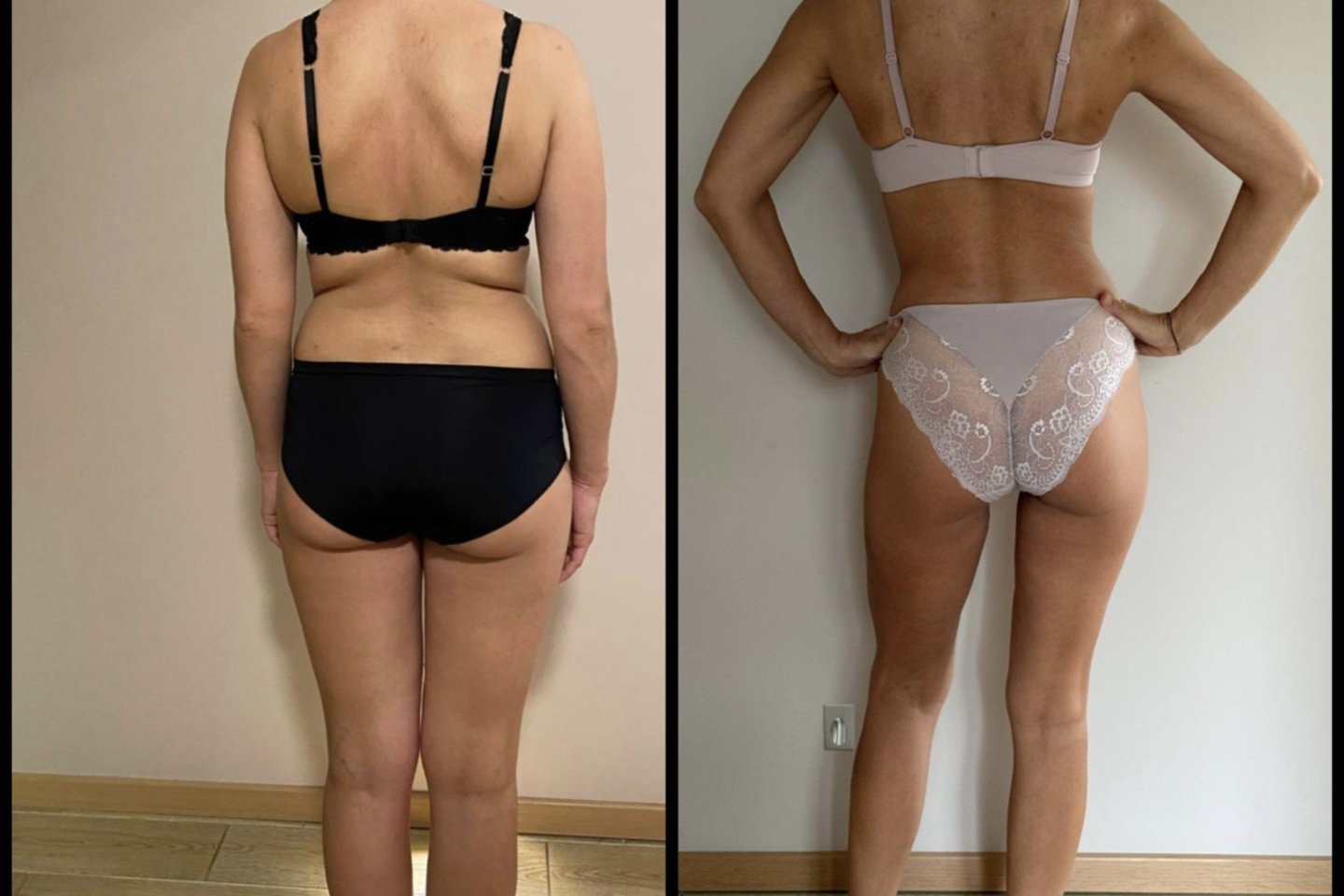 Padidėjęs cholesterolis ir sąnarių skausmai Eveliną lydėjo nuo 28-erių: pakeitusi mitybą jau po poros savaičių verkė iš laimės.<br> Asmeninio albumo nuotr.